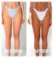Bali Body Ultra Dark Self Tanning Mousse 200ml - British product