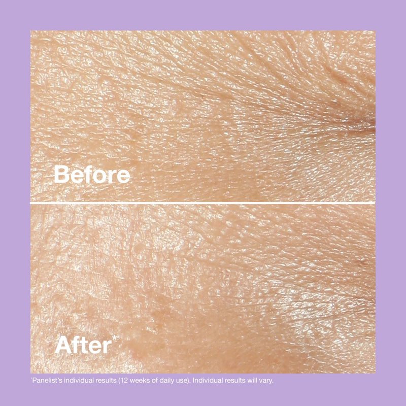 Clinique Smart Clinical Repair Wrinkle Correcting Rich Cream 50ml - British product