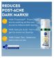 NIVEA Luminous 630 Post-Acne Serum 30ml, imported from the UK