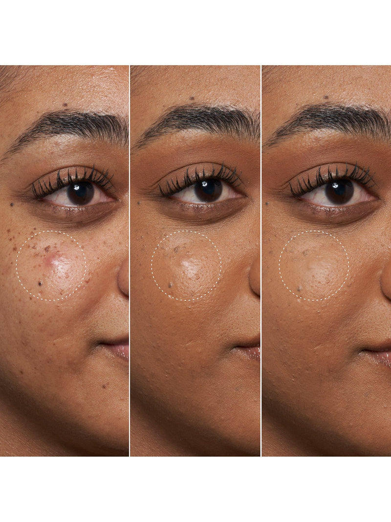 Fenty Skin BHA spot targeting gel 15ml - British product