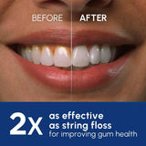 Waterpik Waterflosser Ultra Cordless Plus Electrical Device (British brand)