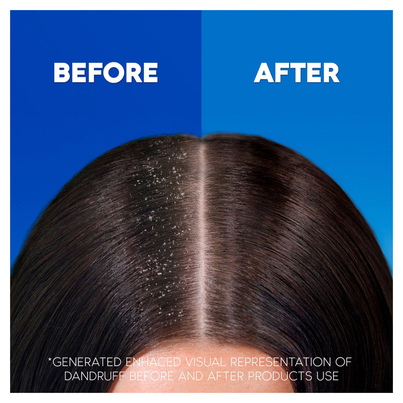 Head & Shoulders Classic Clean Shampoo 2 x 1L, UK version