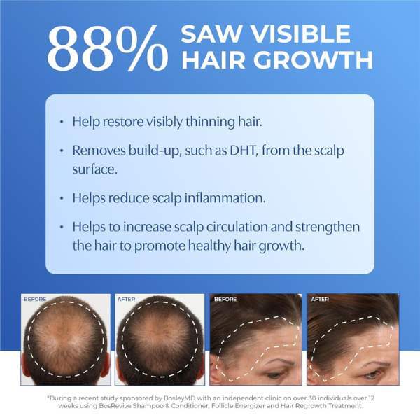 BosleyMD Thinning Hair Shampoo 1L - British product