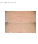 Anti-Ageing Vitamin C and Lactic Acid Face Cream 60ml