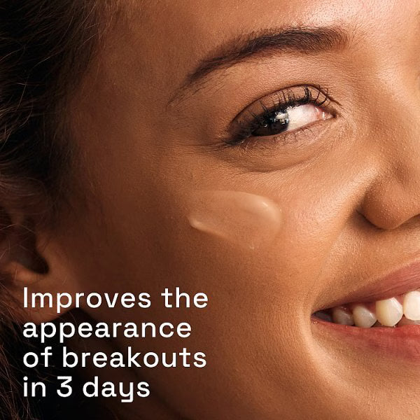 Cetaphil Gentle Clear Triple Action Blemish Serum 30ml - British product