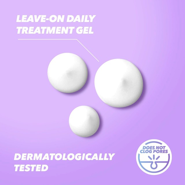 Acnecide spot treatment gel with benzoyl peroxide 15g - British product