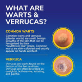 Dr Scholl's FreezeAway Max wart and verruca removal device - British product