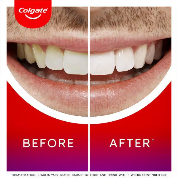 Colgate Overnight Teeth Whitening Serum - British product