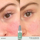 REN Mini Evercalm Redness Relief Serum 15ml, imported from the UK