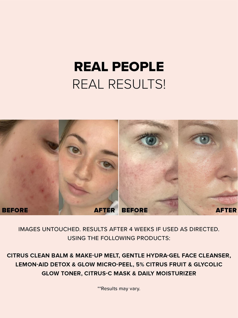 NUDESTIX Nudeskin Gentle Hydragel Face Cleanser 70ml
