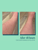 The Everywhere Exfoliator for KP 180ml
