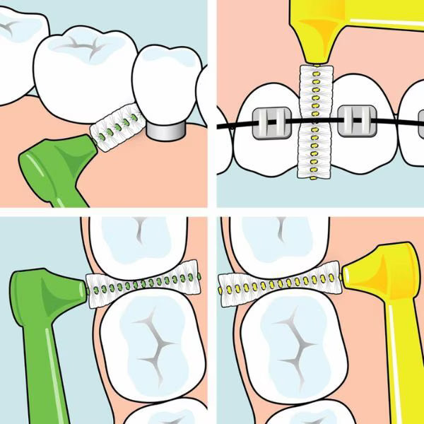 Tepe Angle Interdental Brush Yellow, imported from the UK
