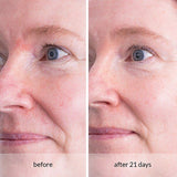 Avon Anew Sensitive & Dual Collagen Cream - McGrocer