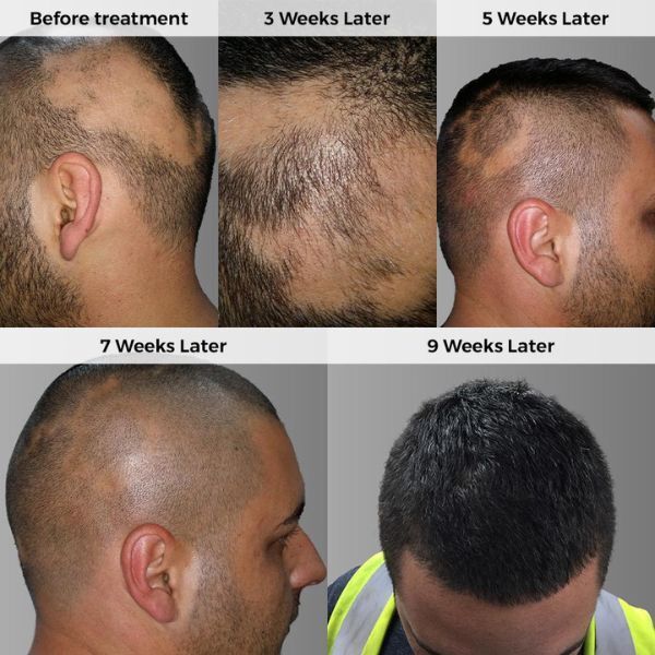 Ayumi Naturals Bio Active Ayumi Hair Growth Oil 150ml - McGrocer