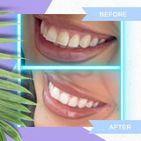 Billion Dollar Teeth Whitening Strips x 28 - McGrocer