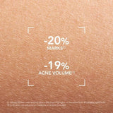 Bioderma Sebium Kerato+ Gel Cream For Acne Prone Skin 30Ml - McGrocer