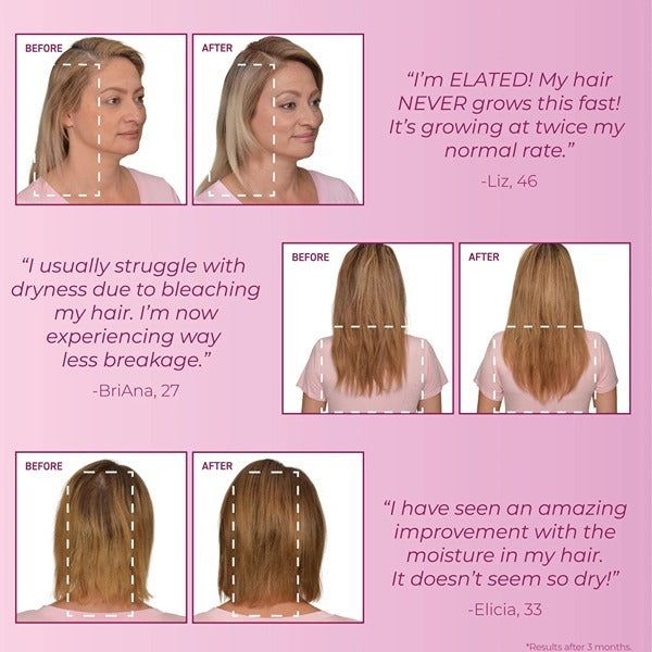 BosleyMD Hair Loss Conditioner MendXtend 300ml - McGrocer