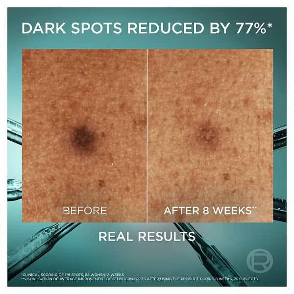 L'Oreal Bright Reveal Dark Spot Serum 30ml, UK version