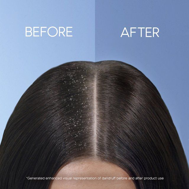 Head & Shoulders Anti Microbial Daily Protect Shampoo 400ML 400ml