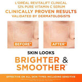 L'Oreal Paris 12% Vitamin C Serum & SPF 50 UV Fluid Duo 50ml