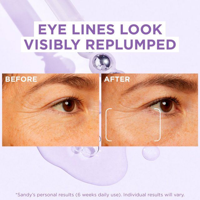 L'Oreal Paris 2.5% Hyaluronic Acid Eye Serum Replumps And De-Puffs Eye 20ml