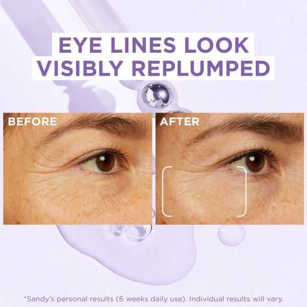 L'Oreal Paris Revitalift Filler Eye Serum 20ml