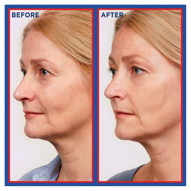 L'Oreal Paris Revitalift Laser Pure Retinol Deep Anti-Wrinkle Night Serum 30ml