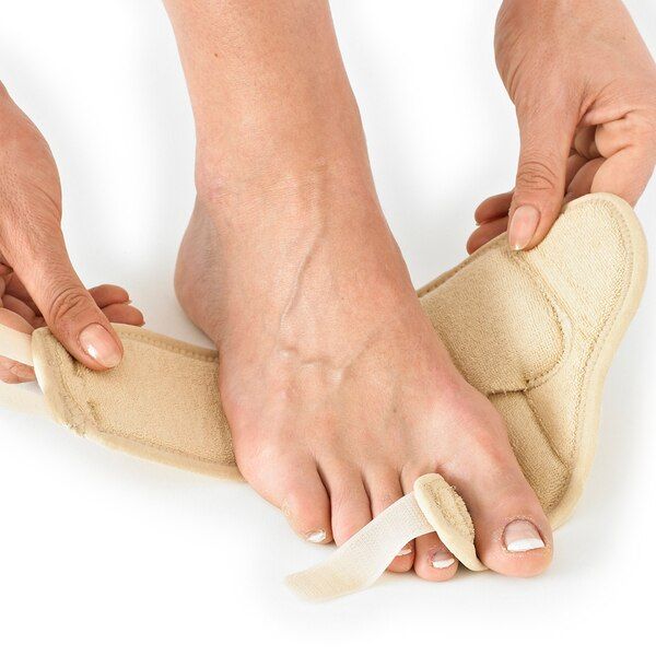 Neo G Bunion Correction System - Soft Support - Left