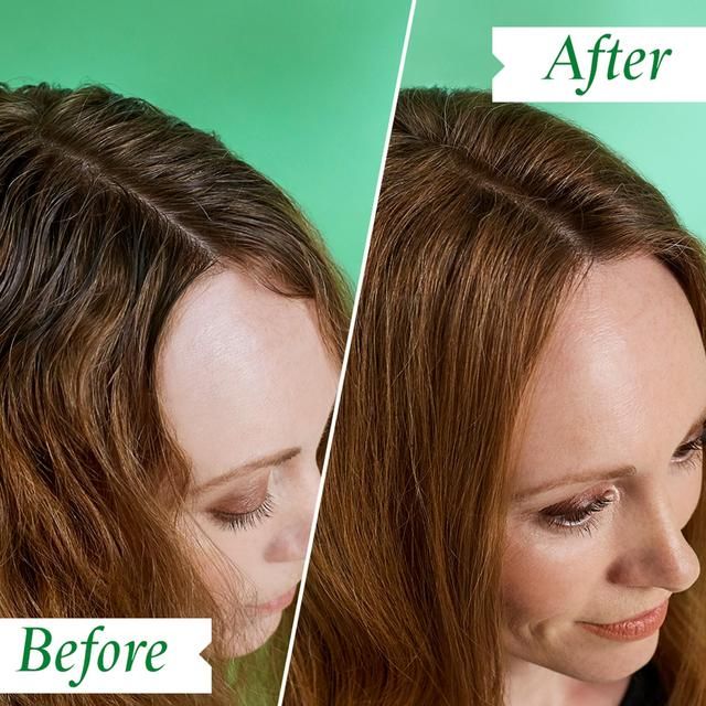 Philip Kingsley Flaky Itchy Scalp Anti-Dandruff Shampoo 500ml