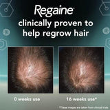 Regaine for Men Extra Strength Hair Regrowth Scalp Foam (3 month supply) 3 per pack