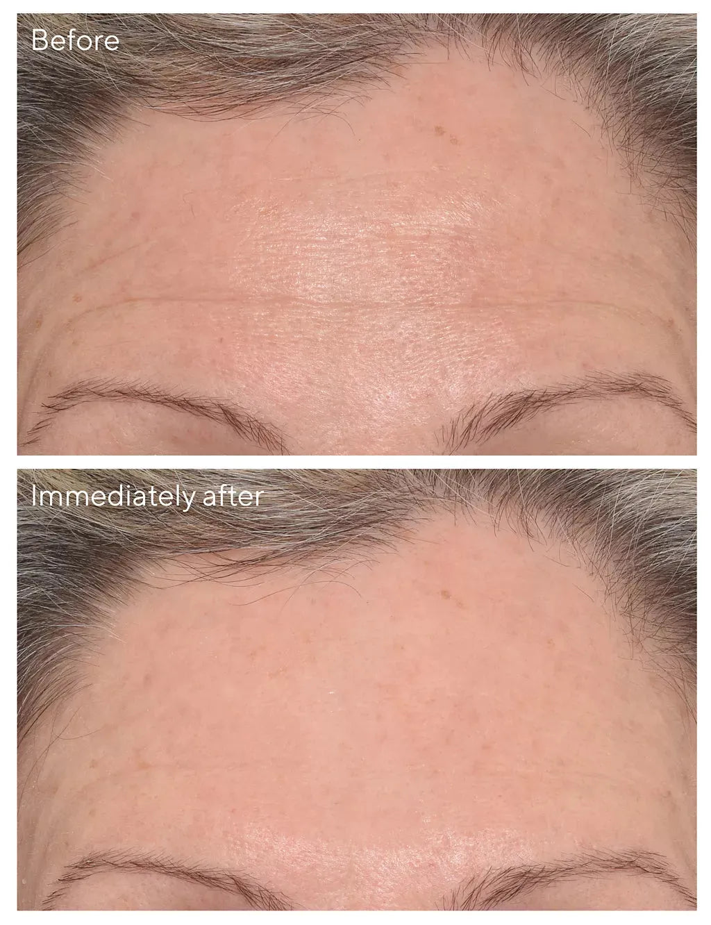 RSG Targeted Wrinkle Corrector 15ml