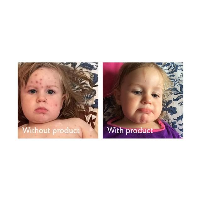 Science of Skin Solution for Scars 30ml