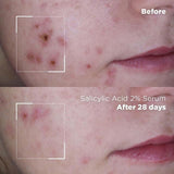 Skin Republic Salicylic Acid 2% Serum 30g