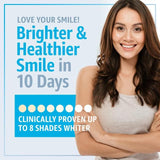 Smile Science Professional Teeth Whitening Kit