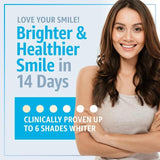 Smile Science Professional Teeth Whitening Strips