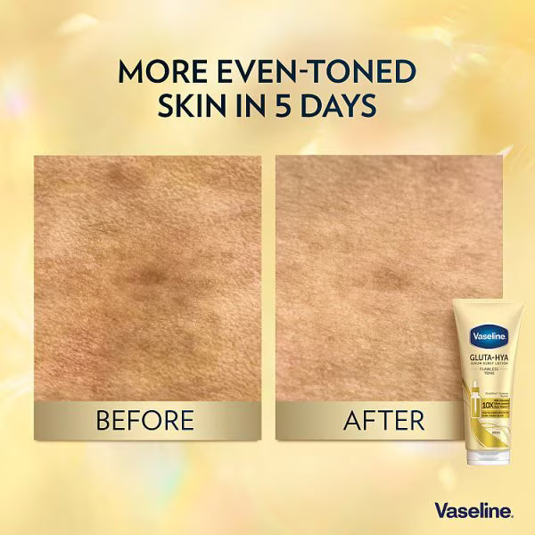 Vaseline Gluta-Hya Serum Burst Lotion 200ml (British brand)