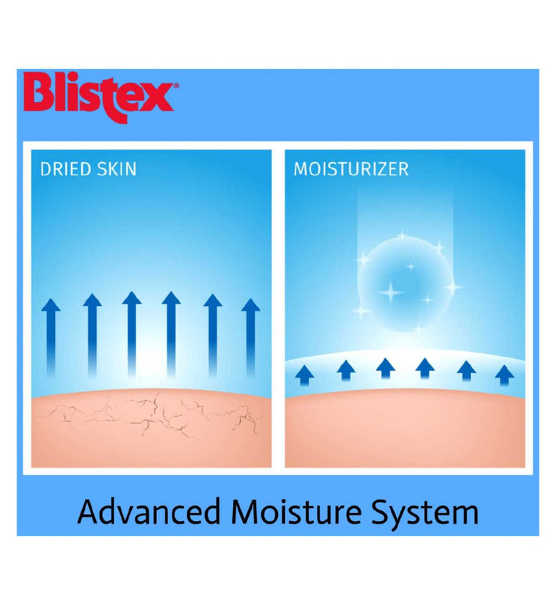 Blistex Intensive Moisturiser SPF10 - British product