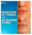 Zovirax Cold Sore Cream Aciclovir 2g (British brand)