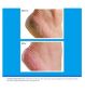 O'Keeffe's Healthy Feet Foot Cream Value Size 180g, imported from the UK