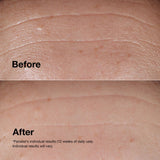 Clinique wrinkle correcting serum 100ml - British product