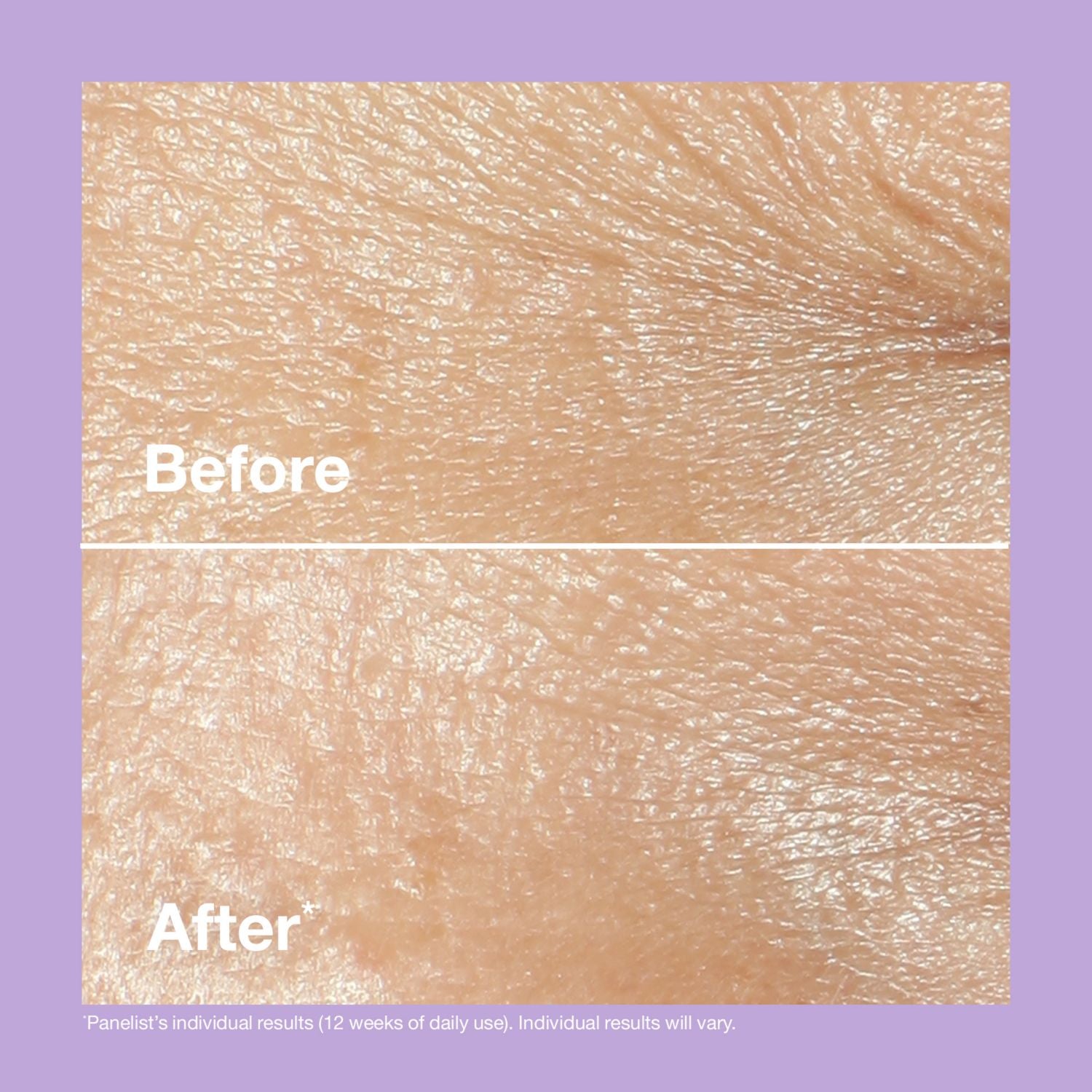Clinique Smart Clinical Repair Wrinkle Correcting Rich Cream 50ml - British product