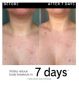 The INKEY List Glycolic Acid Exfoliating Body Stick (British brand)