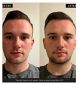 Barber Pro Photon LED Facial Mask Skin Treatment - British product
