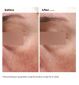 The Ordinary Niacinamide 5% Emulsion Face and Body, imported from the UK