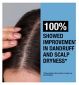 Neutrogena T/Gel anti-dandruff scalp relief shampoo 250ml, imported from the UK