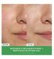 Ole Henriksen Detox Drops Anti-Blemish Toner 120ml, imported from the UK