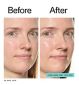 The Inkey List Hydro-Surge Dewy Face Mist 75ml (British brand)