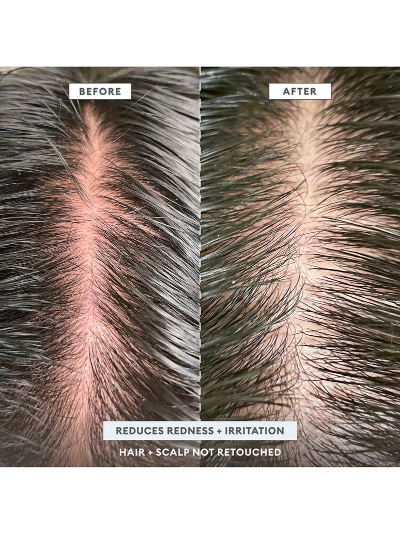 Briogeo Scalp Revival Charcoal Shampoo 248ml - British product
