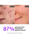 The INKEY List Salicylic Acid Gel Cleanser for Blemish-Prone Skin (British brand)