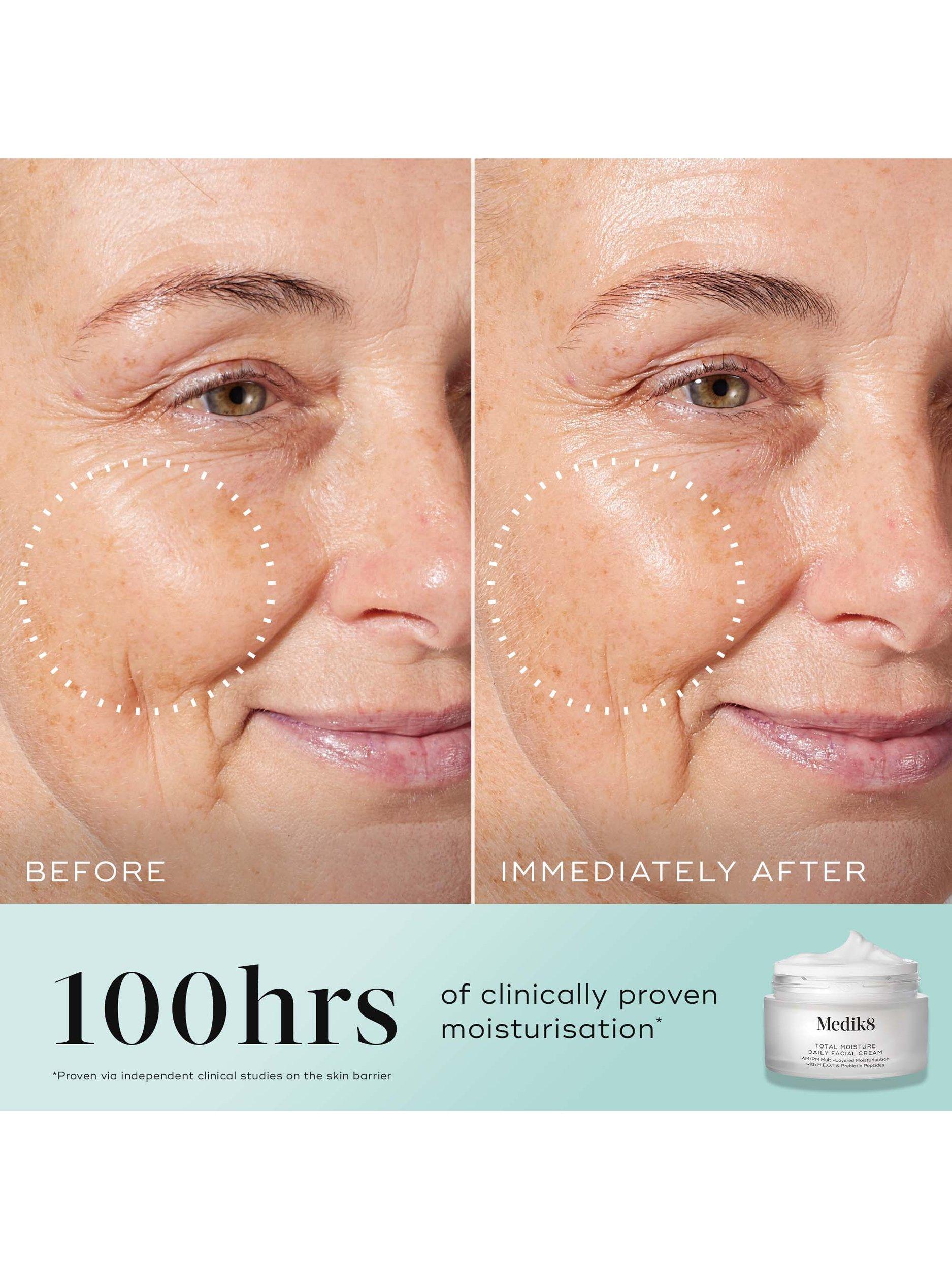 Medik8 Total Moisture Daily Facial Cream Refill 50ml, imported from the UK